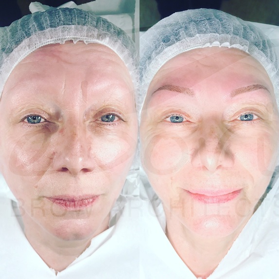 microblading before and after eyebrows